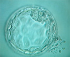 胚（受精卵）凍結法