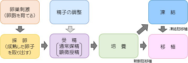 体外受精の流れ