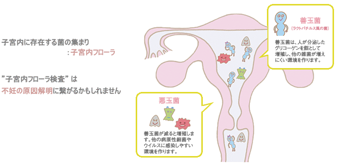 子宮内フローラ検査