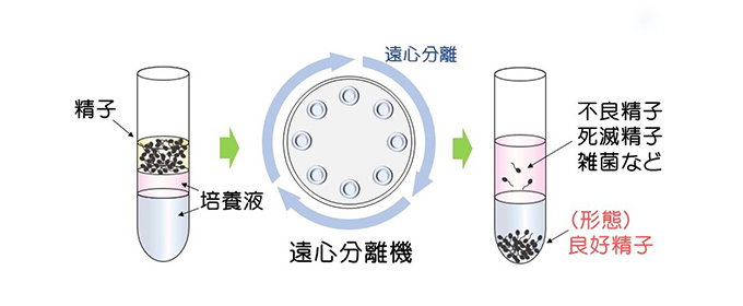 遠心分離機