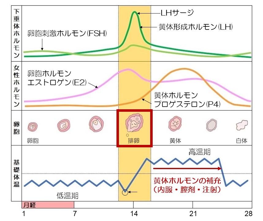 タイミング療法０2