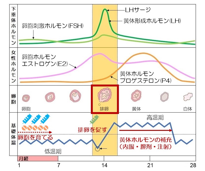 タイミング療法０3