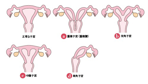 不育症