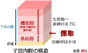 慢性子宮内膜炎