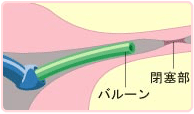ステップ03