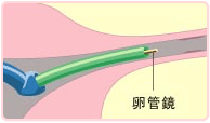ステップ05